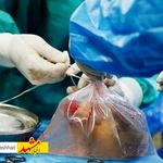 بانوی مرگ مغزی مشهدی به زندگی چهار نفر حیاتی دوباره بخشید