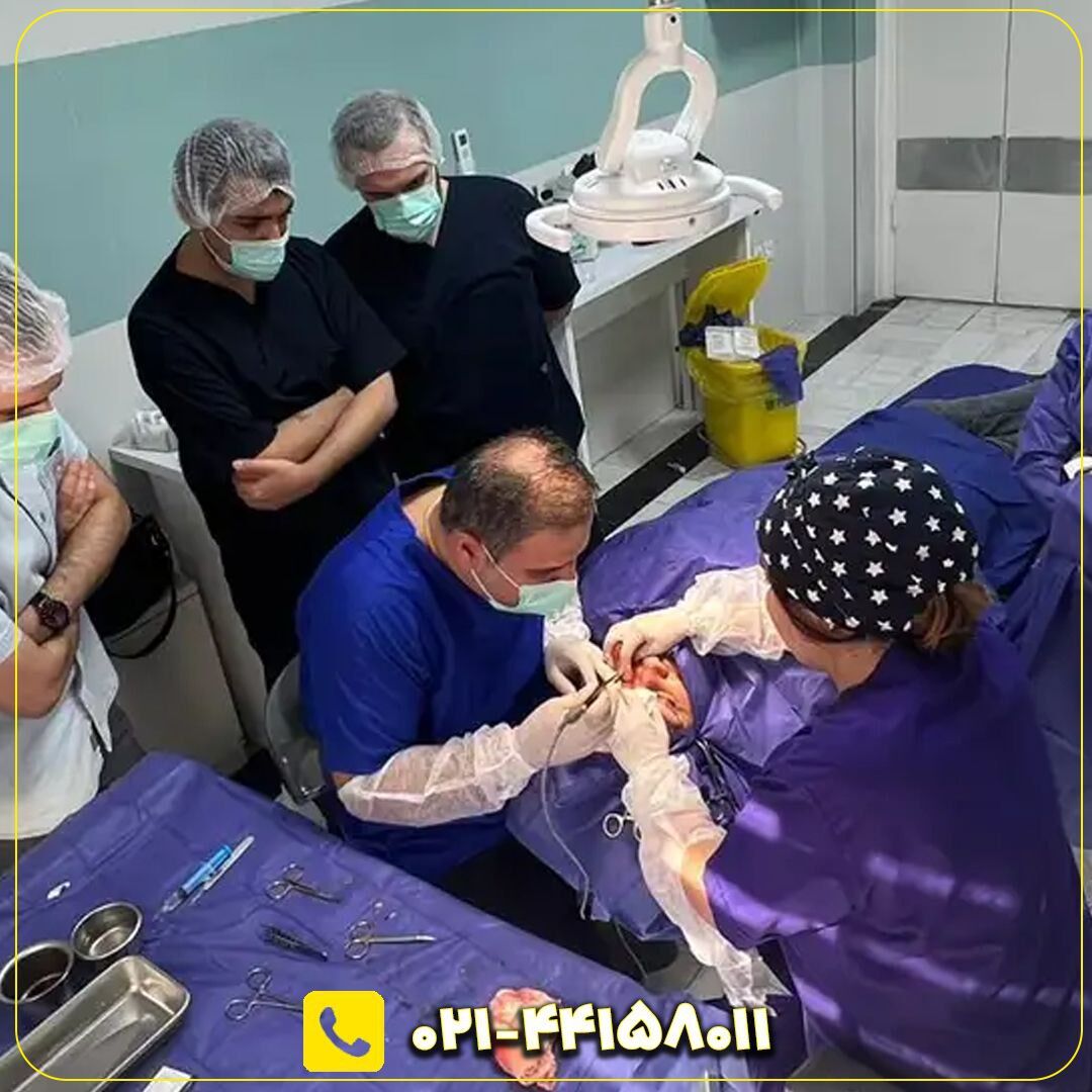  آیا جراحی افتادگی پلک یا بلفاروپلاستی شامل بیمه می‌شود؟ کدام بیمه‌ها؟