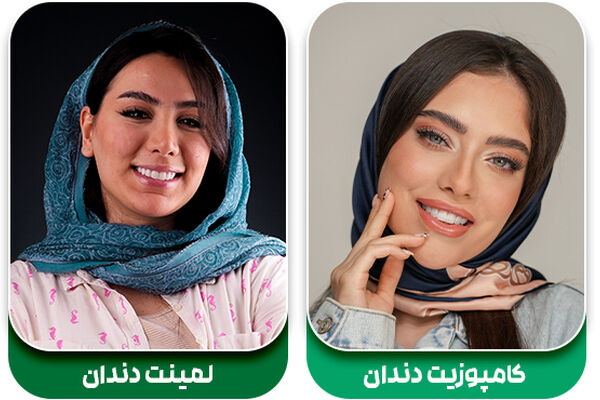 کامپوزیت بهتر است یا لمینت؟ بررسی کامل ویژگی های هر دو روکش
