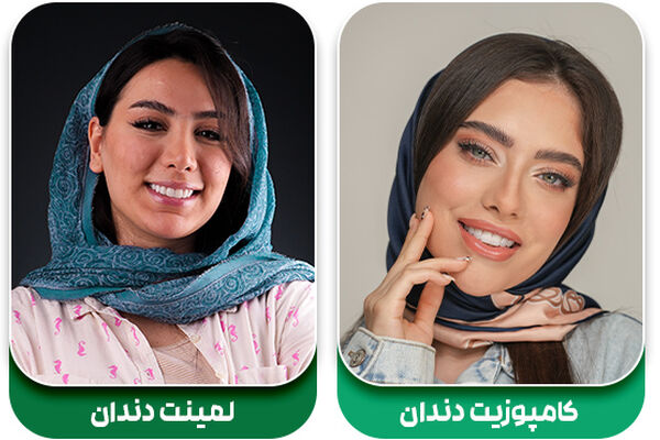 کامپوزیت بهتر است یا لمینت؟ بررسی کامل ویژگی های هر دو روکش