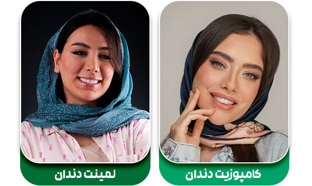 کامپوزیت بهتر است یا لمینت؟ بررسی کامل ویژگی های هر دو روکش