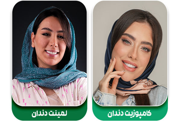 کامپوزیت بهتر است یا لمینت؟ بررسی کامل ویژگی های هر دو روکش