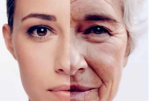 چرا پوست شما با افزایش سن چروک می‌شود