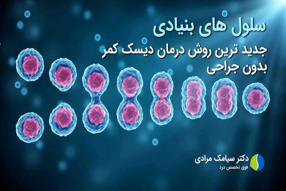 درمان بیماری‌های مفصلی و دیسک کمر با سلول‌های بنیادی
