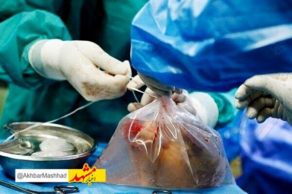 اهدای اعضای بیمار مرگ مغزی مشهدی نجاتبخش جان پنج نفر شد