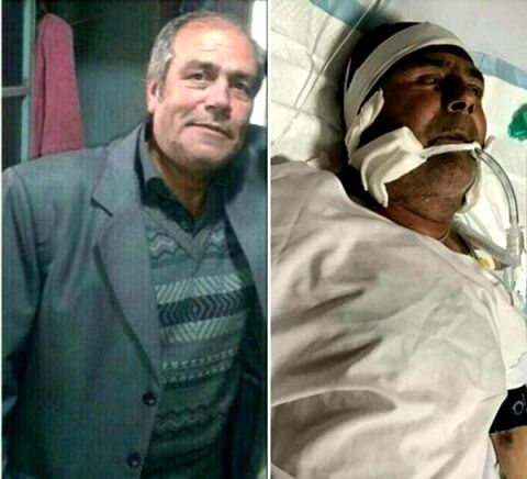 بازیگر «قلاده‌های طلا» تحت عمل جراحی قرار گرفت