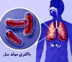 خراسان رضوی رتبه دار ابتلا به سل در کشور