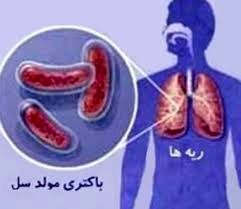 خراسان رضوی رتبه دار ابتلا به سل در کشور