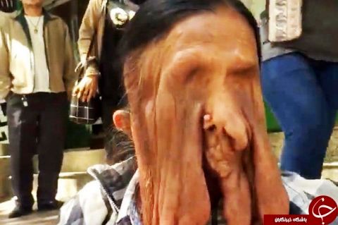 پیرزنی که صورتش در حال ذوب شدن است (۱۸+)