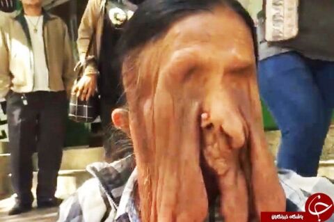پیرزنی که صورتش در حال ذوب شدن است (۱۸+)