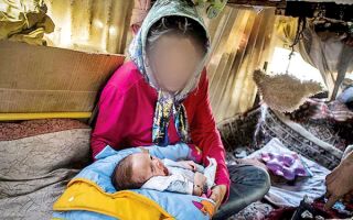به خاطر عقاید خرافی خانواده، صورتم را سوزاندم