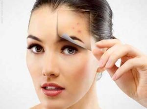 از بین بردن جای جوش با چند روش خانگی و ارزان