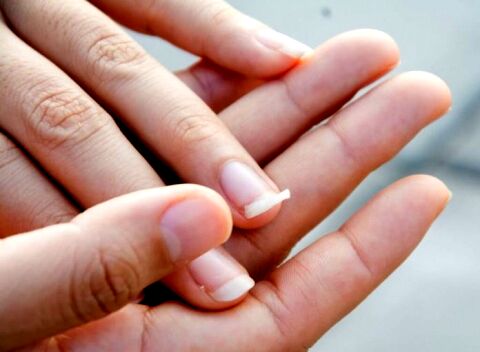 چگونه ناخن شکسته را ترمیم کنیم؟