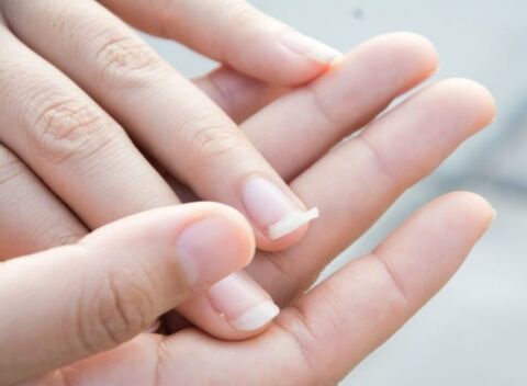 چگونه ناخن شکسته را ترمیم کنیم؟