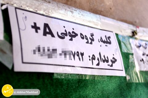 بازار داغ فروش کلیه در مشهد