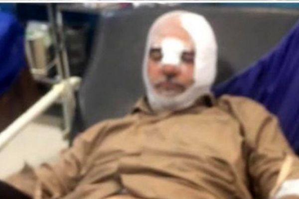 تشریح جزئیات تصادف "الله‌کرم" از زبان خودش