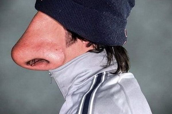 دستگاه‌های کوچک کننده بینی مورد تایید وزارت بهداشت نیست