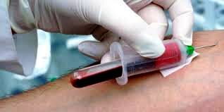 چرا در آزمایش‌های پیش از ازدواج، HIV و هپاتیت لحاظ نمی‌شود؟