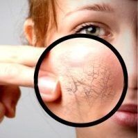 با چند حرکت ساده از چین‌های صورت خداحافظی کنید!