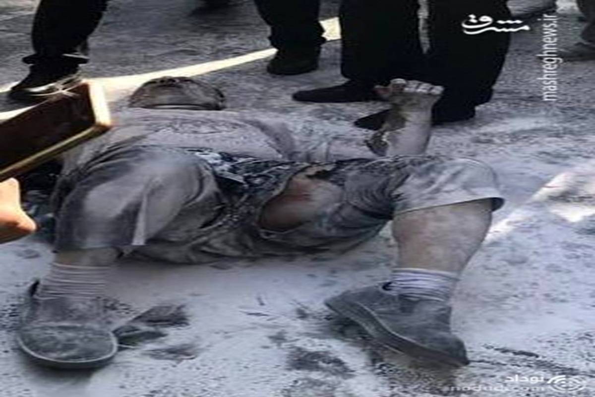 تصویر هولناک از پیکر سوخته مرد میانسال خودسوزی کرده در شهرداری + عکس 16+