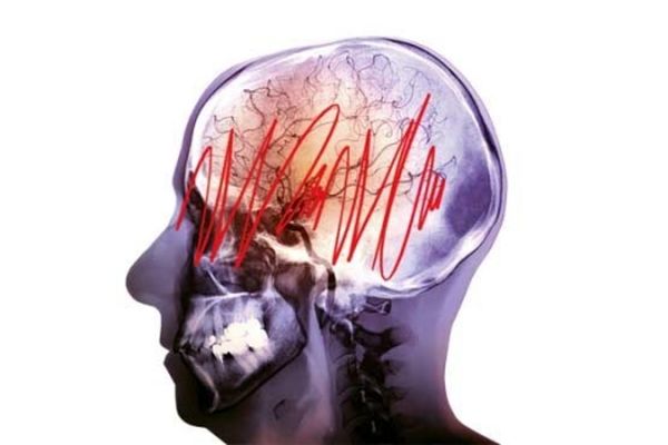 عادات روزمره که برای مغز مضر هستند