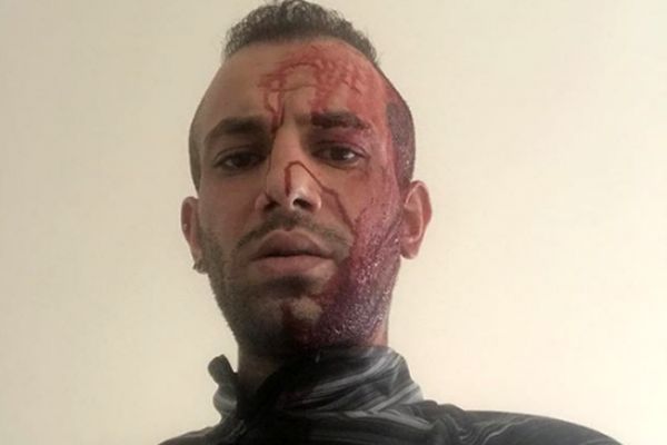 چرا «تتلو» اینطوری است؟