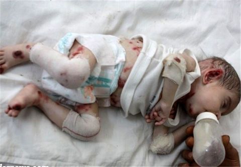 بیماران نادر در سامانه سبنا ثبت نام کنند+جزئیات