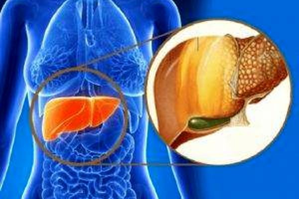 تنها راه و موثرترین روش رهایی از کبد چرب