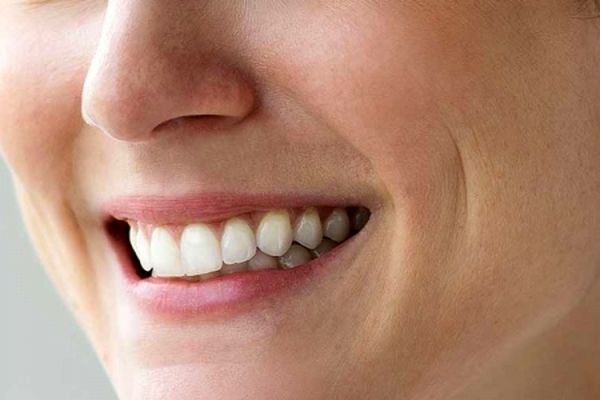 بلایی که تزریق ژل فاسد سر زن جوان آورد