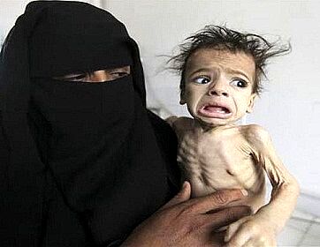 سازمان ملل: جان میلیون‌ها یمنی به دلیل گرسنگی در خطر است