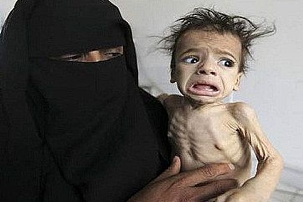 سازمان ملل: جان میلیون‌ها یمنی به دلیل گرسنگی در خطر است