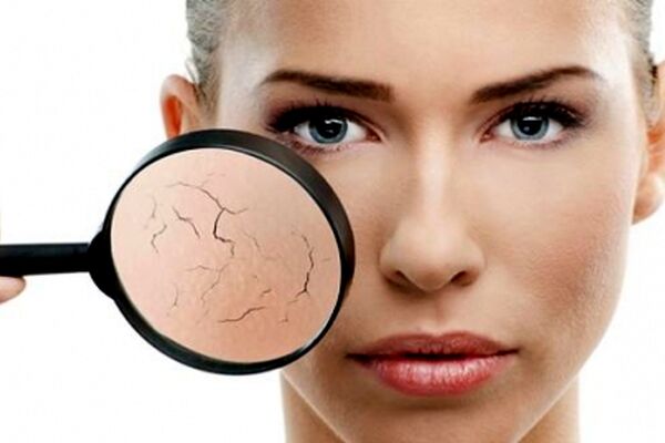 راه‎های رفع خشکی پوست در پاییز