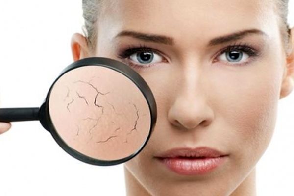 راه‎های رفع خشکی پوست در پاییز