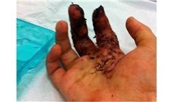 اطلاعات تکمیلی از مدیر مضروب گلبهاری
