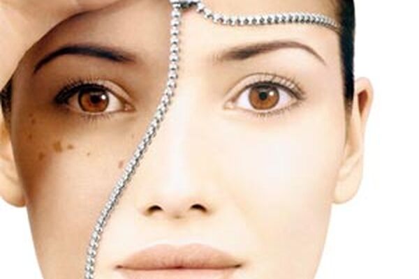 اضطراب چه بر سر پوست تان می آورد؟
