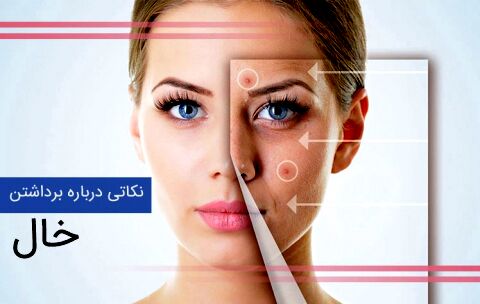 برداشتن خال چه عوارضی دارد؟