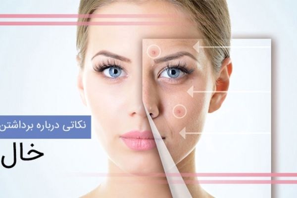 برداشتن خال چه عوارضی دارد؟