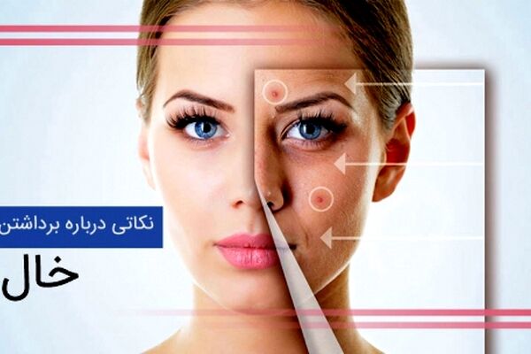 برداشتن خال چه عوارضی دارد؟