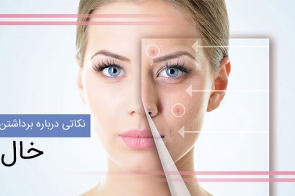 برداشتن خال چه عوارضی دارد؟