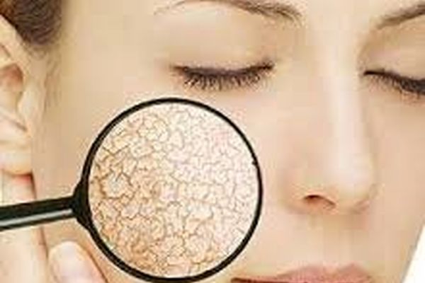 آیا از پوست خشک خود خسته شده اید؟