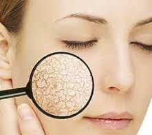 آیا از پوست خشک خود خسته شده اید؟