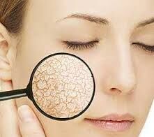 آیا از پوست خشک خود خسته شده اید؟