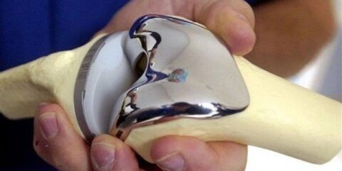 اگر به دنبال افزایش قد با جراحی هستید، بخوانید