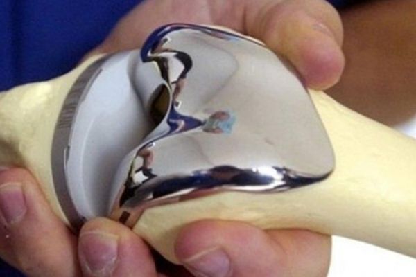 اگر به دنبال افزایش قد با جراحی هستید، بخوانید