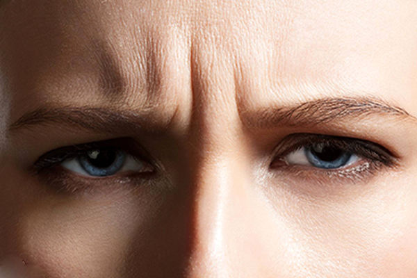 خط اخم‎ خود را با درمان‌های خانگی از بین ببرید