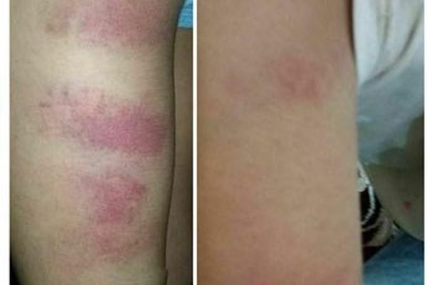 واکنش آموزش‌وپرورش به تنبیه بدنی با کابل؛ گفته بودیم خط قرمز است