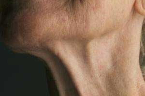 برای چروک های گردن از کرم صورت کمک بگیرید