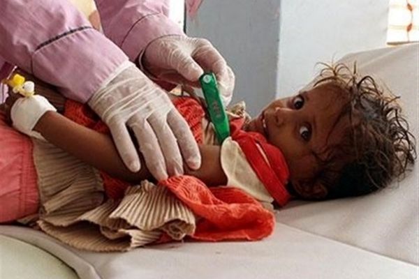 یونیسف: یمن جهنم کودکان است