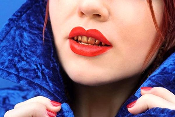 لاک های دندان هم وارد بازار مد شد