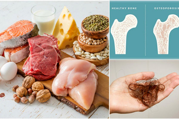 چگونه متوجه شویم کمبود پروتئین داریم